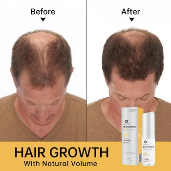 HAIRCUBE Hızlı Saç Büyüme Spreyi Anti Saç Dökülmesi Ürünleri Erkekler Kadınlar için Saç Rejenerasyon Özü Yağı Saç Besleyici Serum Sıvı